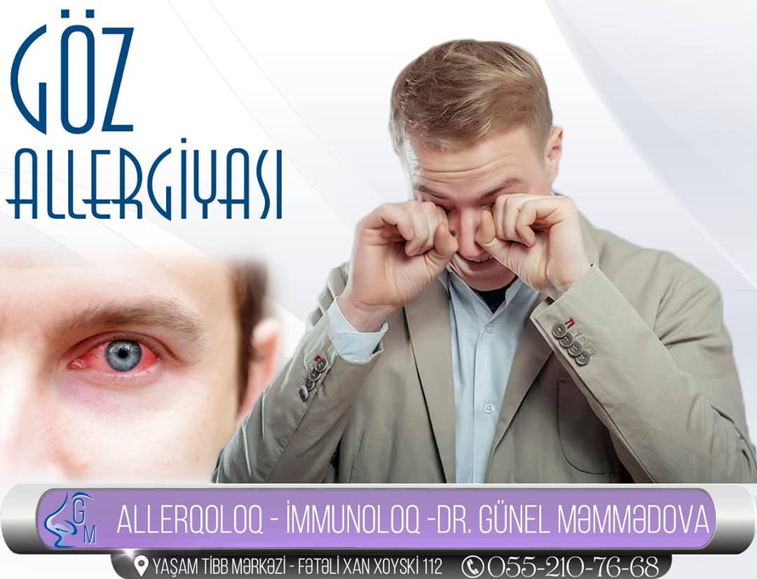 Göz allergiyasının diaqnostikası